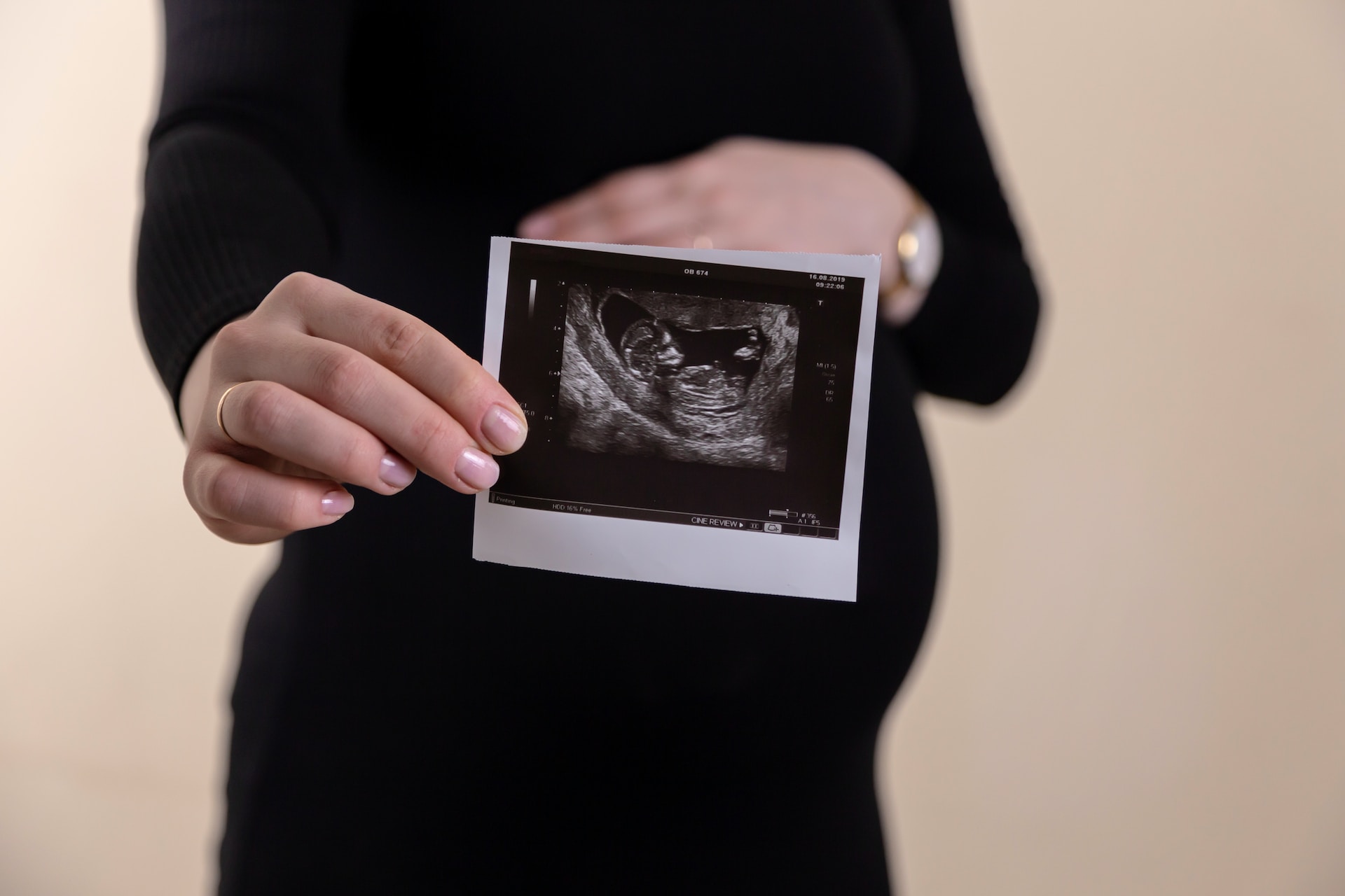 Rola prenatalnych badań diagnostycznych w monitorowaniu zdrowia ciąży
